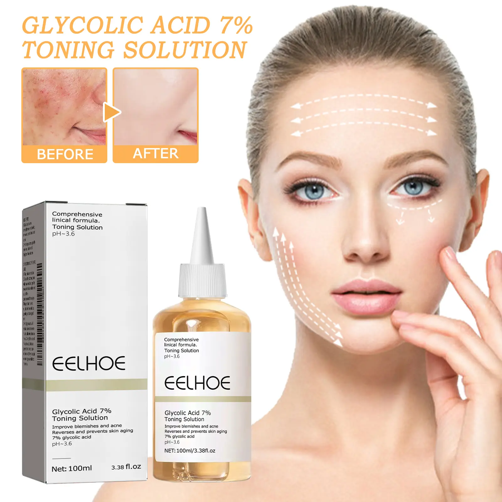 Buy one get one free,EELHOE 7% GLYCO-POLICE TONER ​ "Issues Pore Arrest Warrants + Deletes Scar Evidence! Acne Aloe Case Clear Cotton Pads Glycolic Green Tea Hyaluronic