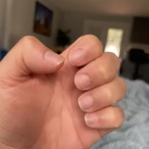 Product Review of Radiant Cosmetics Nail Growth Oil - 100% Organic, Moisturizing, Growth, Strengthening, and Brightening Formula with Vitamins and Fatty Acids for Overall Nail Health from j**e