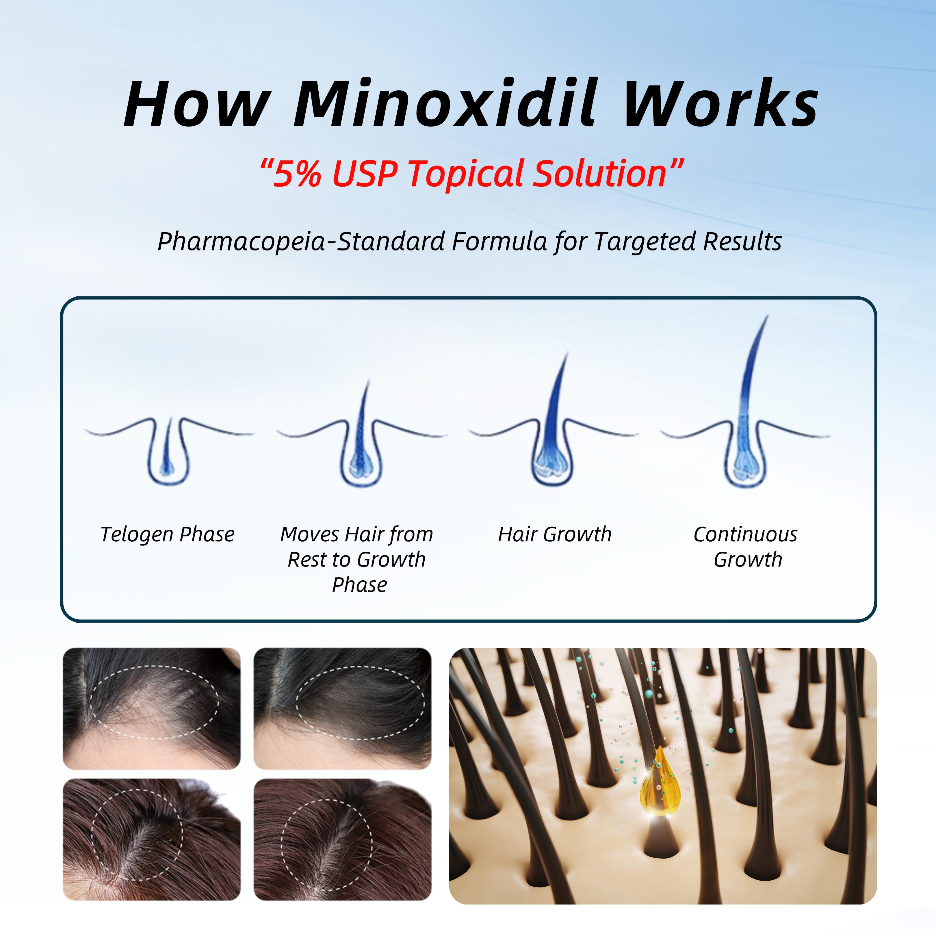 Sytael Hair Follicle Activating Shampoo for Anti-Hair Loss and Hair Growth uses pure natural plant extracts and is suitable for people with androgenetic alopecia, alopecia areata, postpartum, and post-hair transplant conditions.