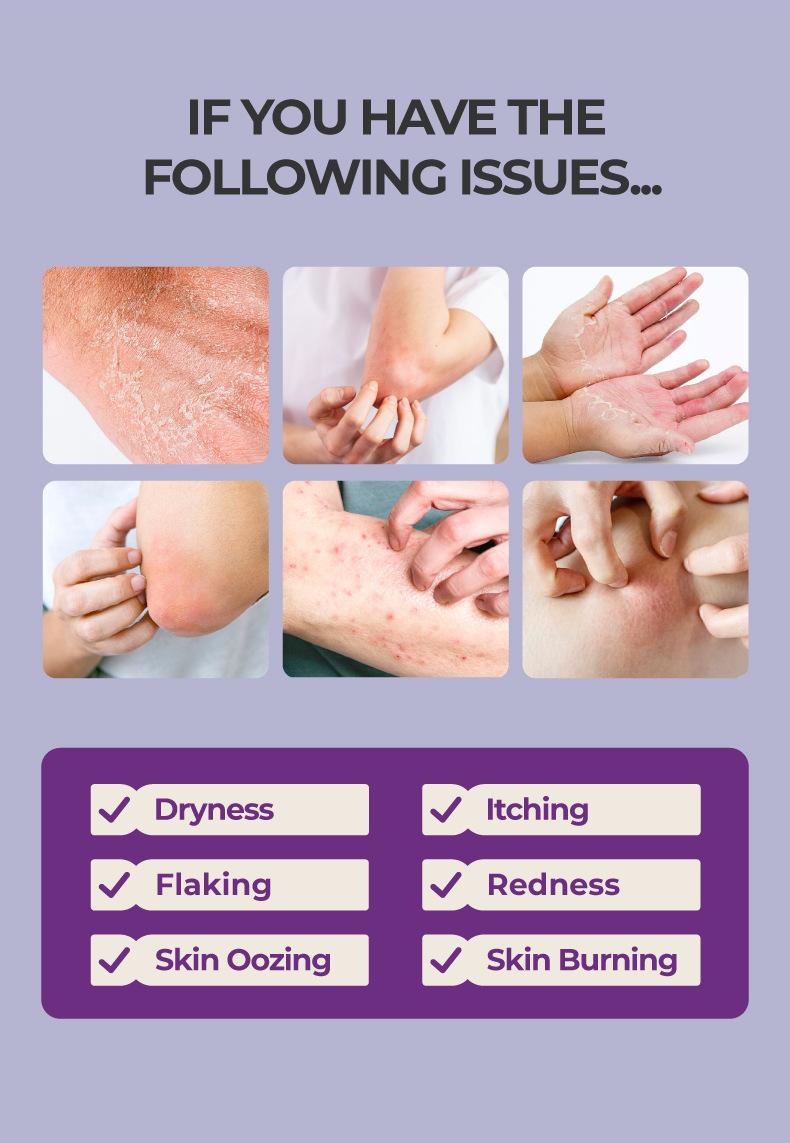 Skin Soothing Cream 20g/Tube, Gentle Relief for Itchy, Red & Flaky Skin, Daily Body Care Essential