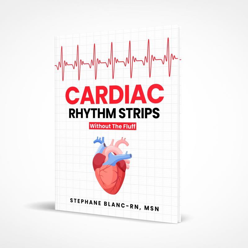 Cardiac Rhythm Strips Without The Fluff | Nursing Study Guide | ECG ...