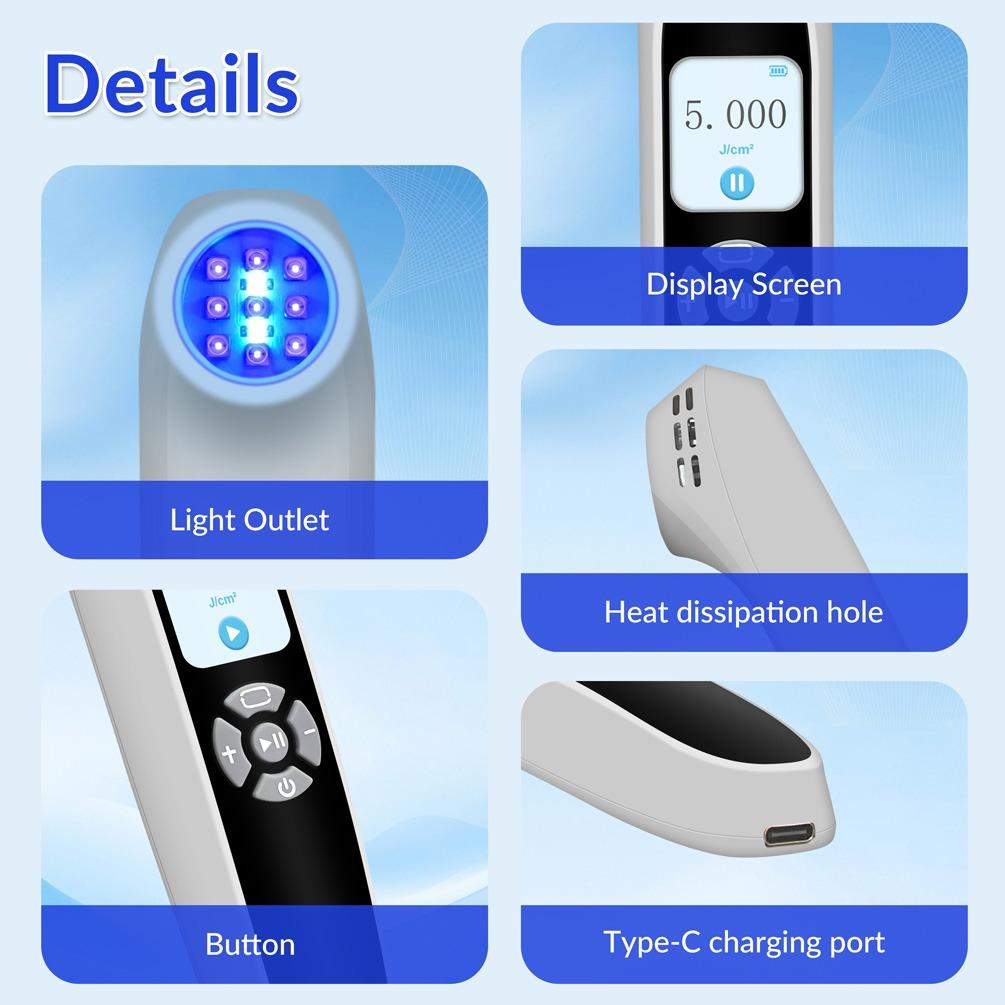 ZJZK 9 Diodes 308nm UVB Excimer Phototherapy Device, 55mW/cm² High Energy Density, Handheld Blue Light Skin Treatment, Targeted Therapy for Vitiligo, Psoriasis, Eczema, Atopic Dermatitis, Portable Home Use for Skin Disorders