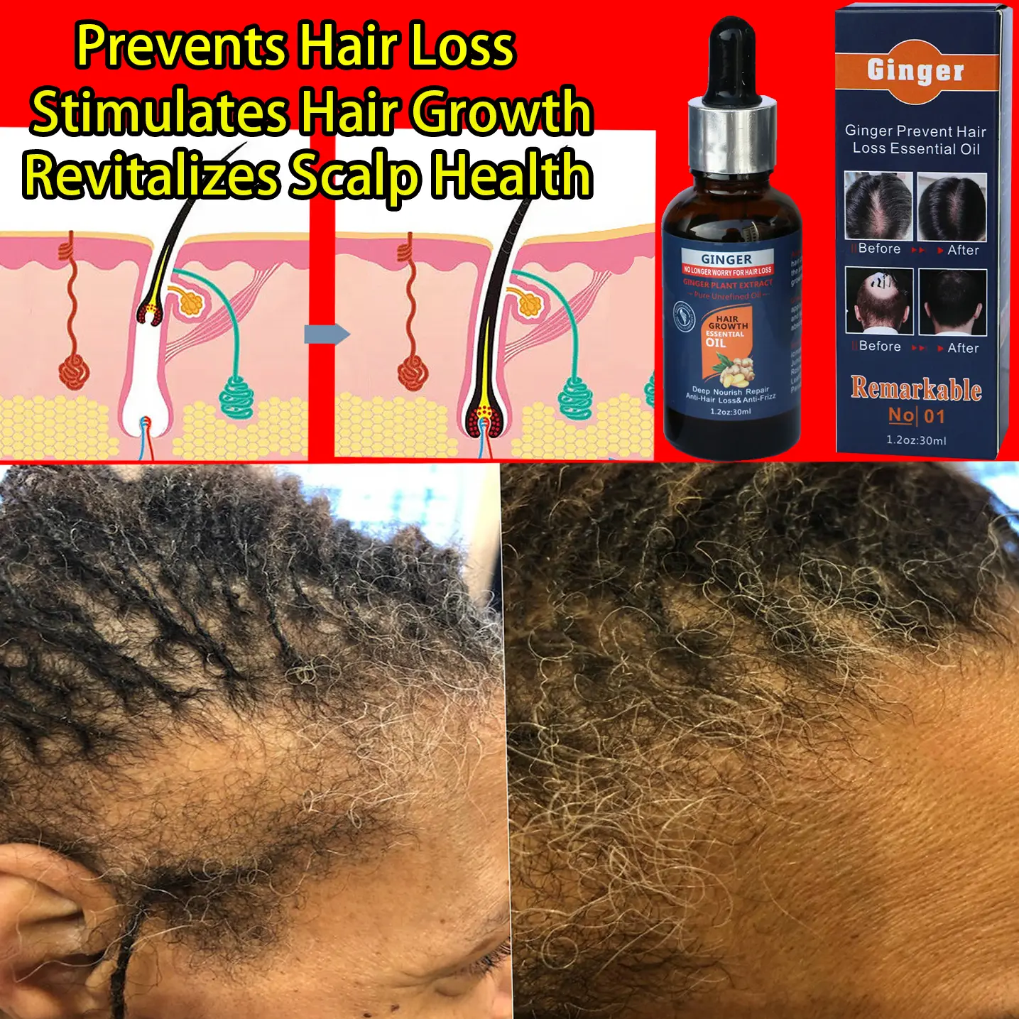 Best-Selling Ginger Hair Growth Serum – TikTok Trending! Powerful Natural Plant Formula with Collagen, Caffeine & Rosemary to Strengthen Roots, Repair Follicles, Prevent Hair Loss & Promote Regrowth. Fast 7-Day Visible Results!