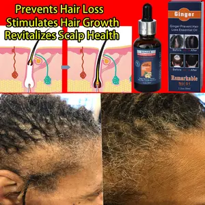 Best-Selling Ginger Hair Growth Serum – TikTok Trending! Powerful Natural Plant Formula with Collagen, Caffeine & Rosemary to Strengthen Roots, Repair Follicles, Prevent Hair Loss & Promote Regrowth. Fast 7-Day Visible Results!