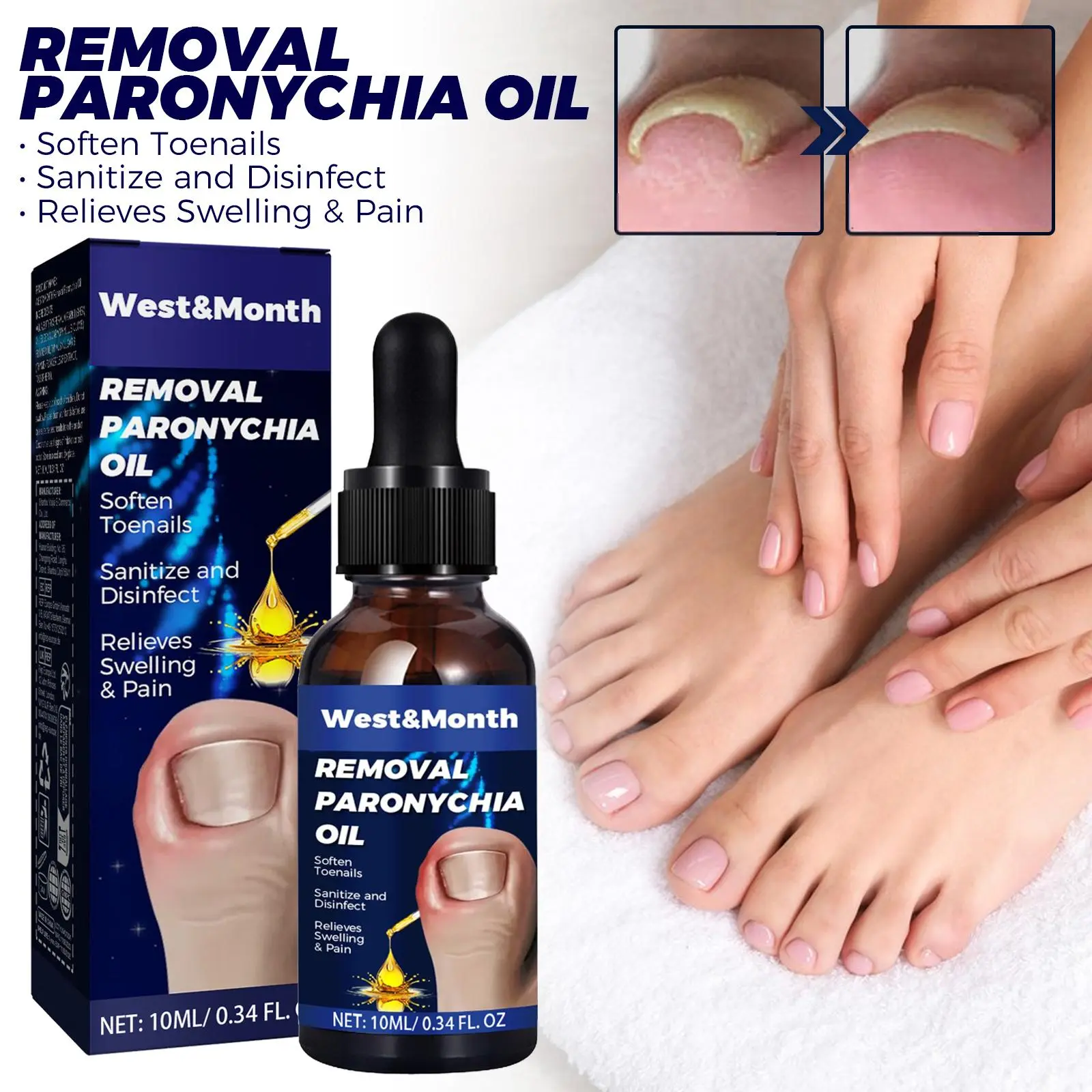 Paronychia Nursing Oil Anti Paronychia Care Oil Cuticle Care Treatment Repair for Thick Nails Soften Toenails