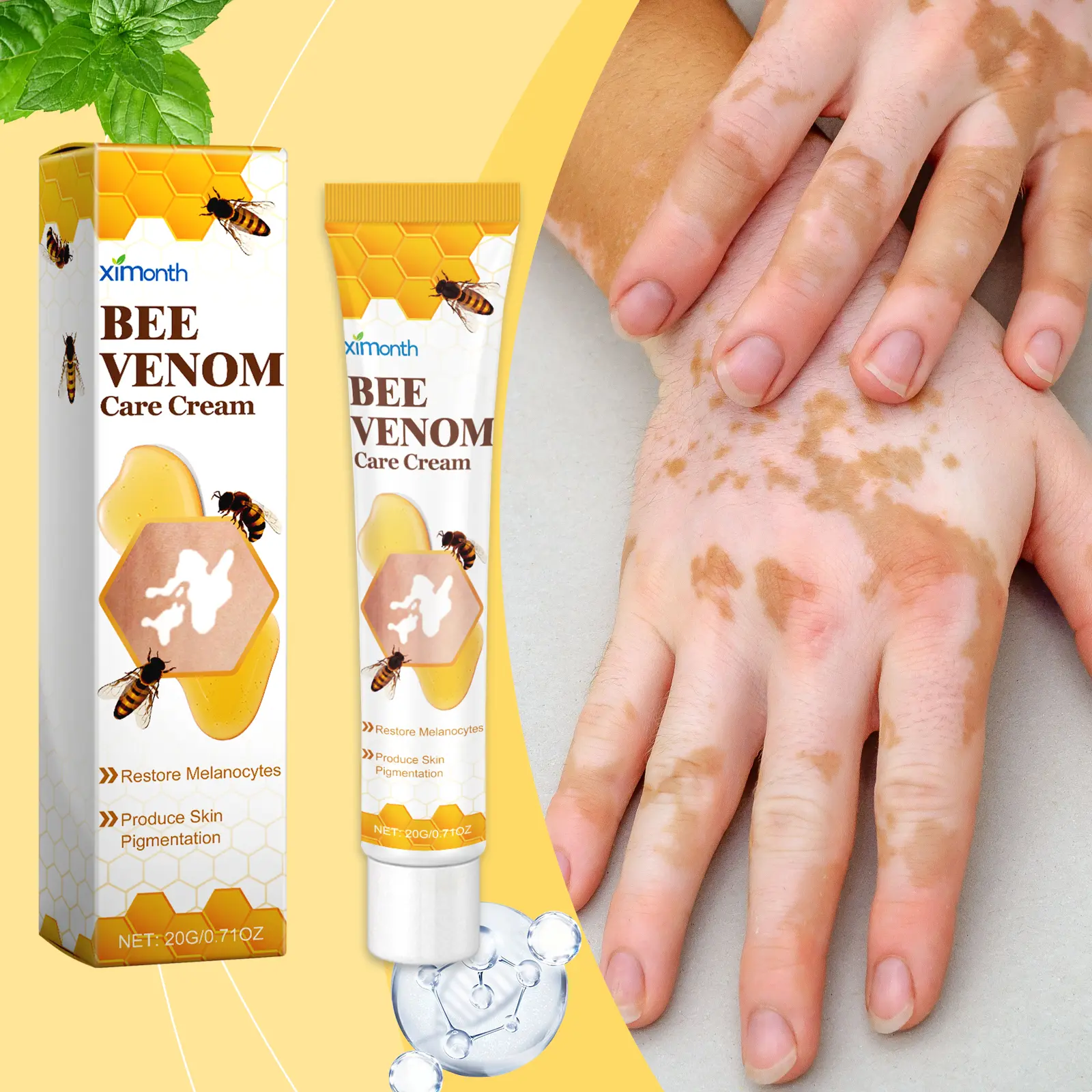 Vitiligo Bee Venom Treatment Cream, Skin Topical Cream, Bee Venom Treatment, Natural Formula