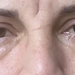 Product Review of [NEW] [medicube] Mix & Match Eye Serum Set | Brightening, Elasticity & Puffiness Care for Smooth, Radiant & Youthful-Looking Eyes | Korean Skincare, K-Beauty from l**4