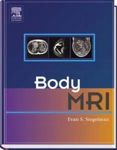 USED-Body MRI by Evan Siegelman (Hardcover)