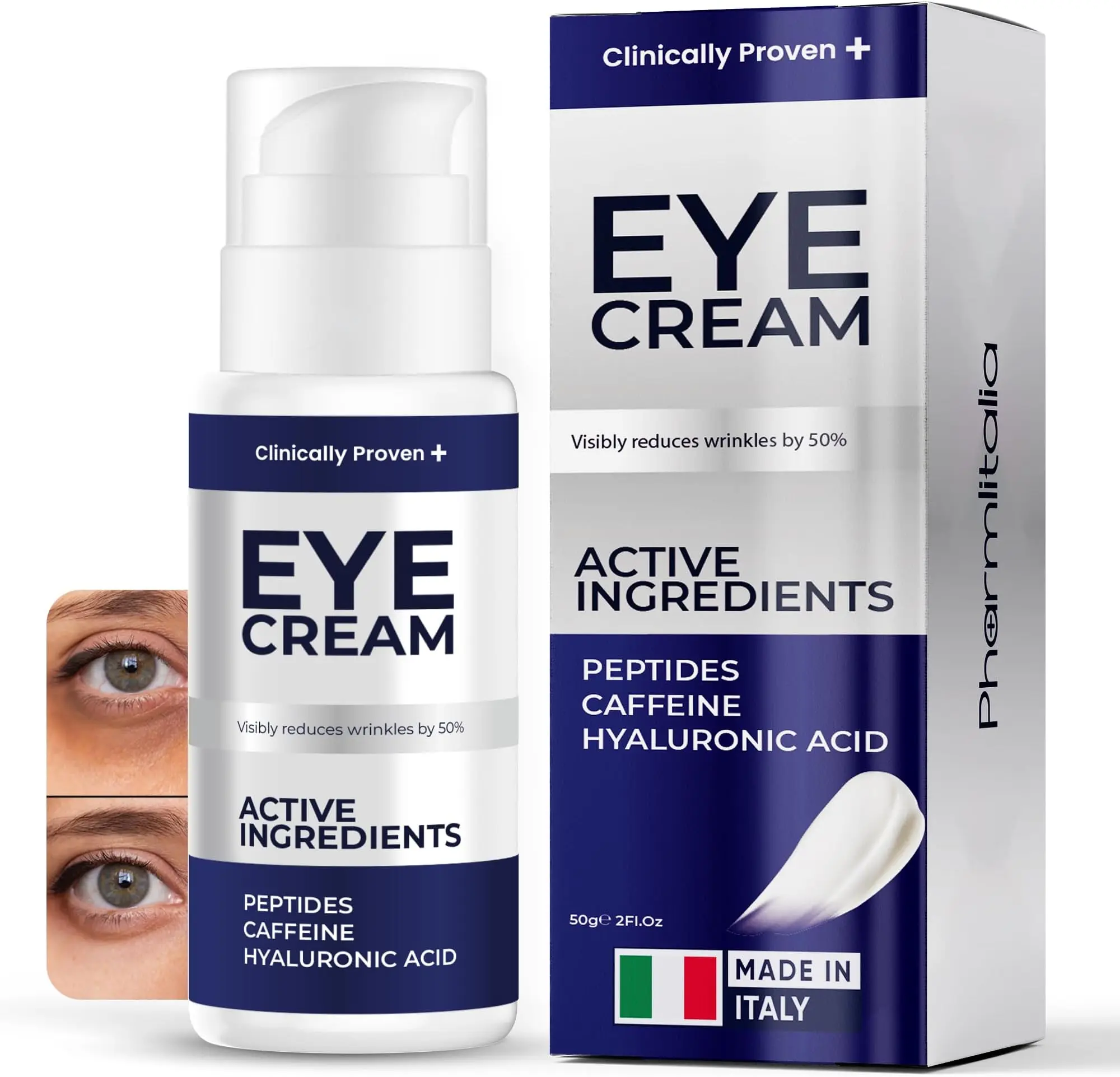 Under Eye Cream for Puffiness & Dark Circles: Retinol, Hyaluronic Acid & Caffeine for Baggy Eyes – Suitable for Men & Women! Hydrating Under