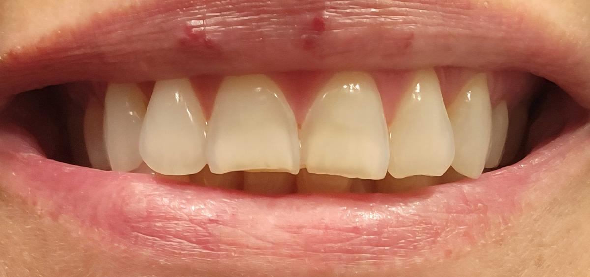 Item: 1 pc (Trial Packing)