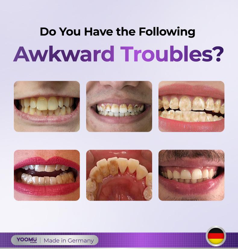 YOOMU 2 Purple light activates the whitening toothpaste, freshens breath, deeply cleans the mouth, and brightens the teeth.