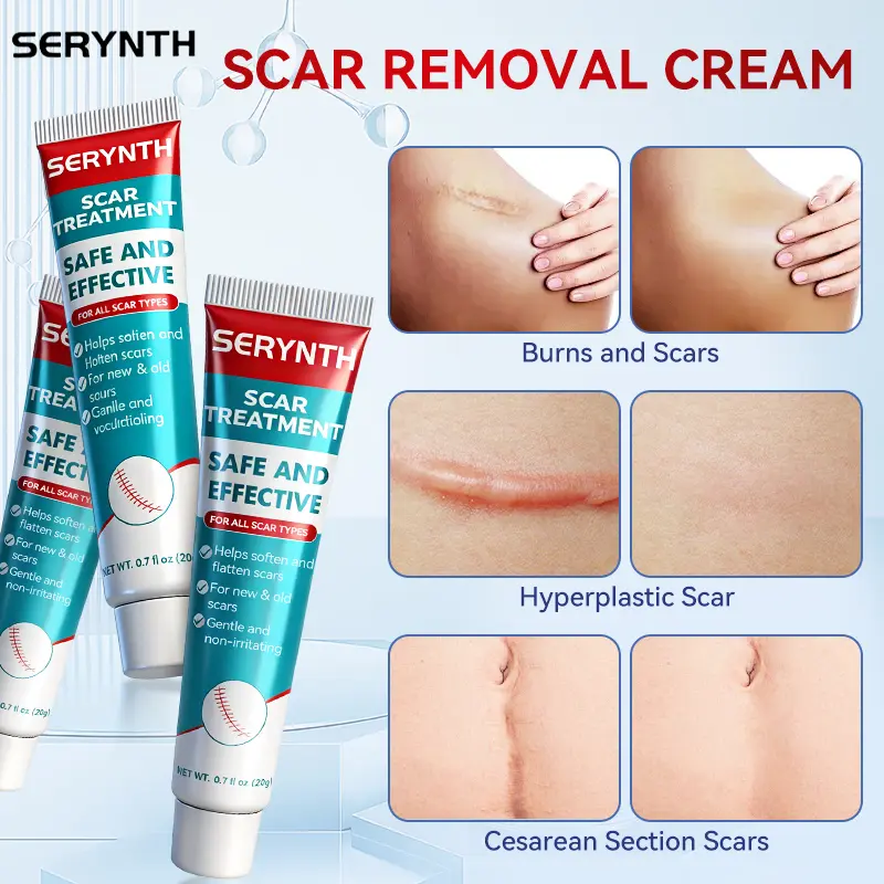 Scar Cream, Professional Scar Removal Creamfor Surgical Scars,Stretch Mark, Keloid Bump,C-Section, Scars of Burns and Injuries,Old andNew Scars Acne Skin Repair