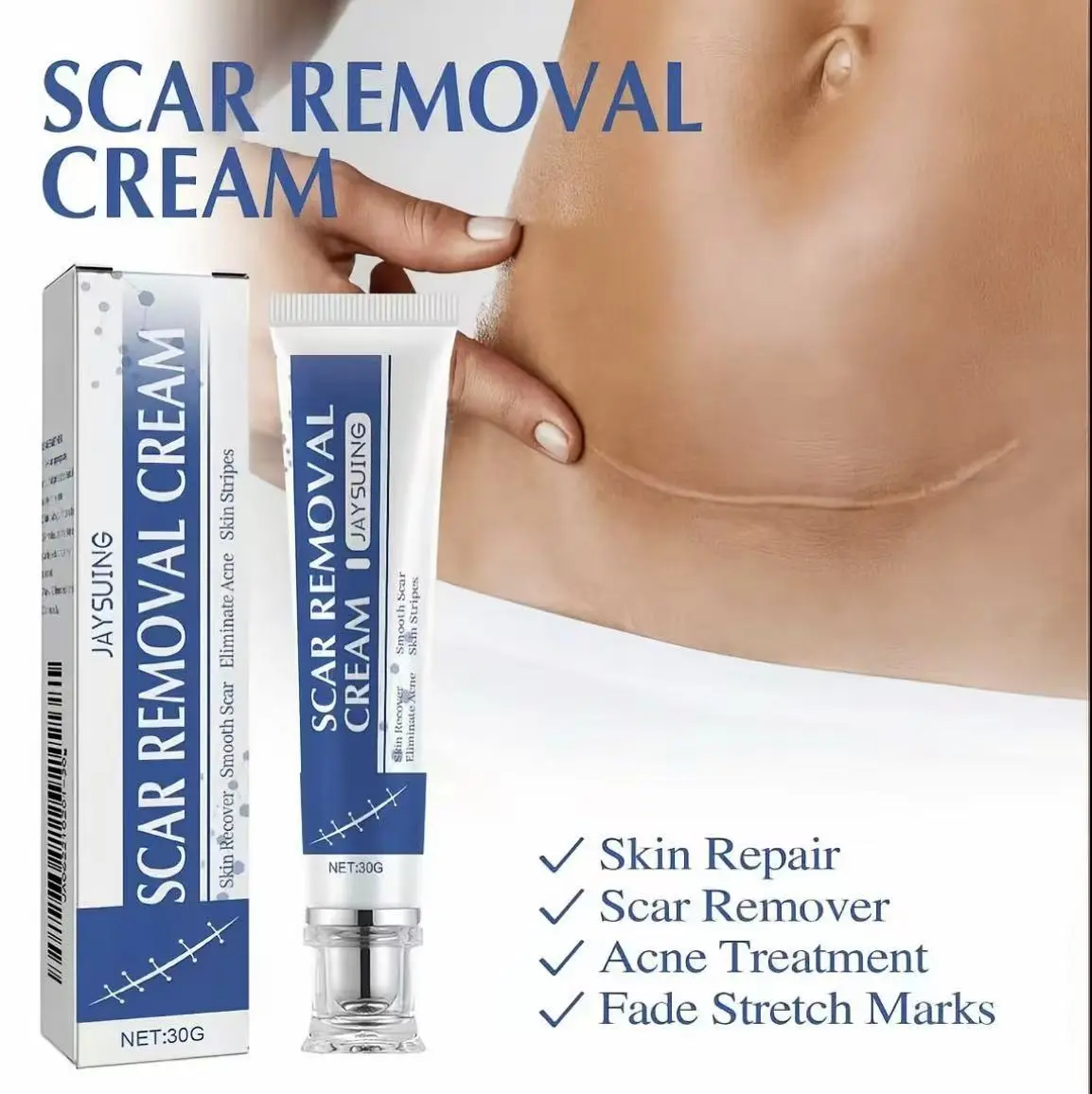 Professional Scar Removal Gels(30g), Advanced Silicone Scar Removal Cream, for Burn, Acne, Old Scar Removal Cream for Face & Body, Fades Dark Scars, All Natural Ingredients, Gentle Formula