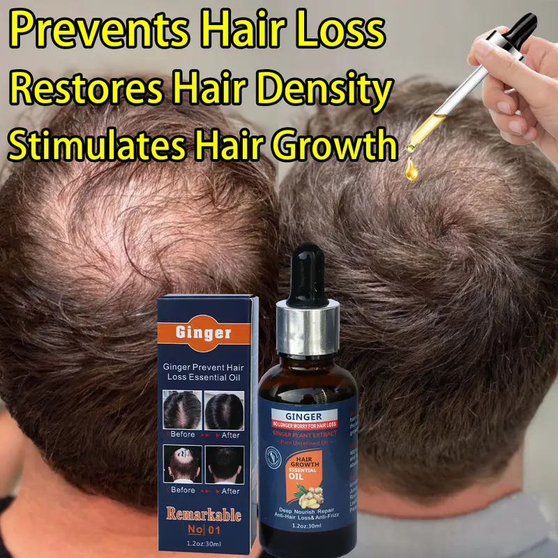 Clinically Proven Ginger Hair Growth Oil – Dermatologist Recommended! Natural Extracts with Caffeine & Rosemary to Repair Follicles, Stop Hair Loss, Boost Regrowth, Deep Nourishment for Men & Women. Visible Thick, Healthy Hair in 7 Days!