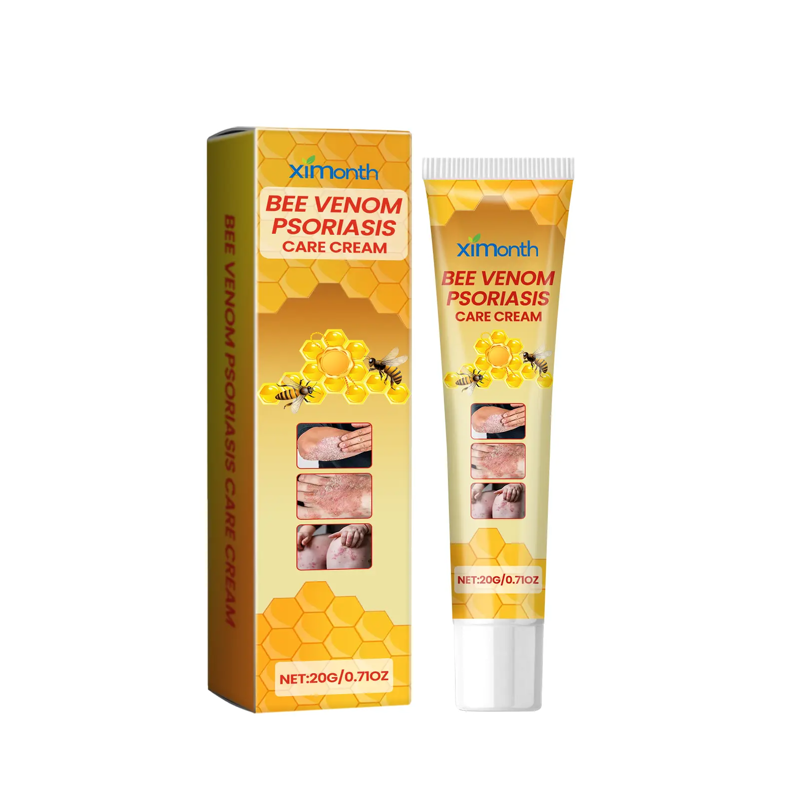 Ximonth Psoriasis Treatment Cream - 20g Body Balm for Psoriasis Relief, Itchy Skin, Redness, Swelling