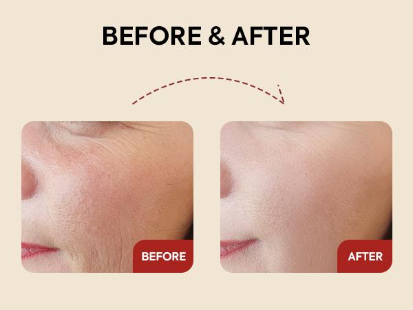 K-SECRET SEOUL 1988 Retinal Serum: 2% Retinal, Black Ginseng, Niacinamide, Bakuchiol, Vitamin C & Peptides for Wrinkle Care, Korean Skincare - 30mL