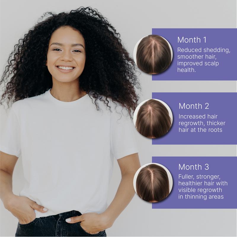 Mama Locks Growth Oil - 2 fl oz for Healthy Postpartum Hair Regrowth - Reduces Shedding Strengthens Follicles Improves Scalp Health Haircare Haircare