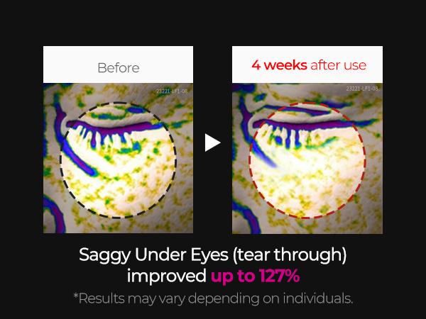 [Dr. Melaxin Official] Cemenrete Calcium Intense Ampoule Plus | Anti-aging, Elasticity, Volume | Korean Cosmetic | 30ml