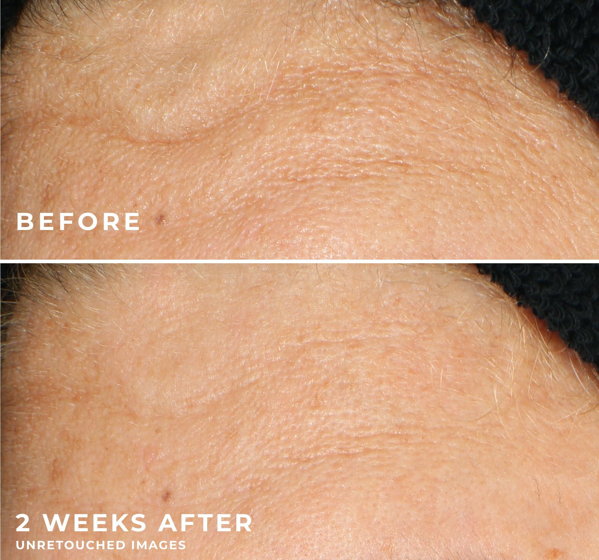 [RoC Skincare] MULTI CORREXION Revive + Glow Gel Cleanser