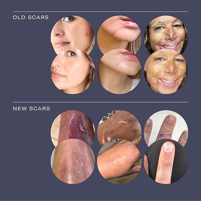 ESTAS Daily Dose Scar Cream Serum - Lightweight Hydrating Moisturizer with Hyaluronic Acid & Vitamin E for Smoother Skin Repair & Visible Results - Moisturizing