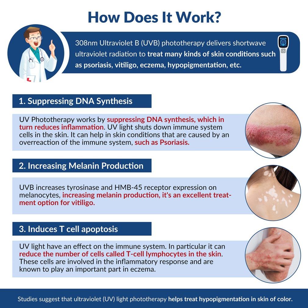 ZJZK 308nm Excimer Phototherapy Device with 64 Diodes, Blue Light Therapy for Vitiligo, Psoriasis, Eczema, Atopic Dermatitis, Fungal Skin Disease, Hypopigmentation, Safe Targeted Home Use, Fast Recovery, Prevent Recurrence, Portable Handheld