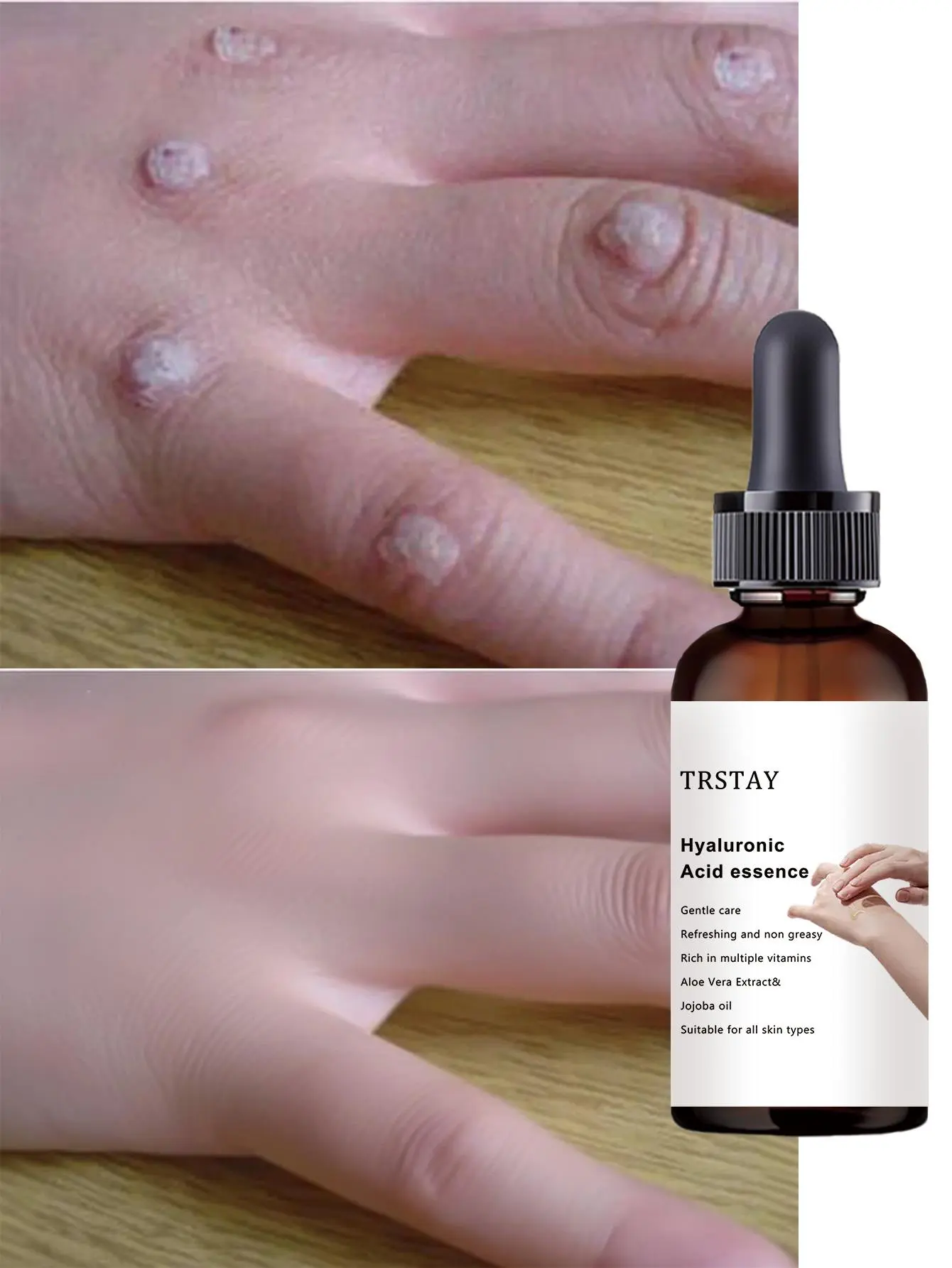 Vitamin C Body Oil — Moisturizing and nourishing, care for dry skin, deep hydration, and radiance-enhancing; suitable for daily body care.