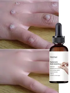 Vitamin C Body Oil — Moisturizing and nourishing, care for dry skin, deep hydration, and radiance-enhancing; suitable for daily body care.