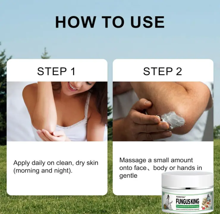 [Purchased by 10,000+ Users] "Fungus King" Herbal Care Balm — Topical Antibacterial & Anti-Itch Cream for Hands & Feet — Gentle & Skin-Friendly Formula