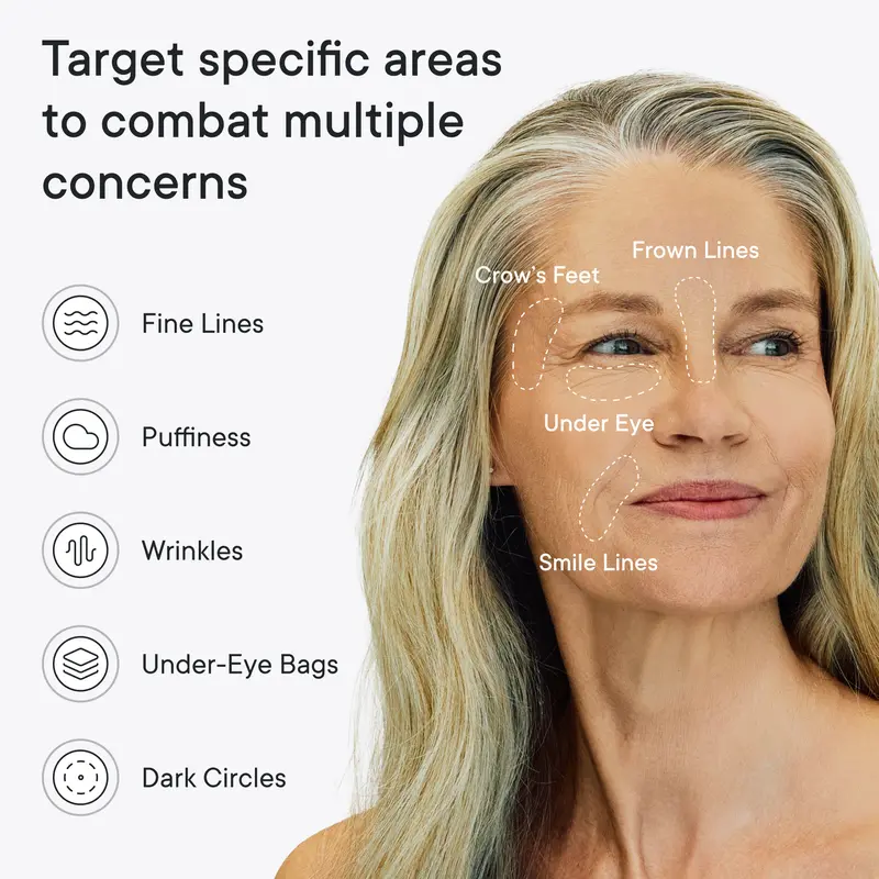 Qure Micro-Infusion Anti Wrinkle Patches for Smile Line, Frown lines, Under Eye Bags, Puffiness, Crow's Feet - Retinol, Niacinamide, Caffeine, Peptides - Dissolvable for Overnight Use - 8 Pairs 2