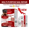 SOVS Extra Strength Toenail Fungus Treatment - 1 fl oz Natural Antifungal Solution with Triple-Action Herbal Blend, Healthy Nail Growth Oil, Adults' Nail Care, Orchid Nourish, Smooth Edges, Manicure Support, Water-Based Boost (2 to 3 Application Note)