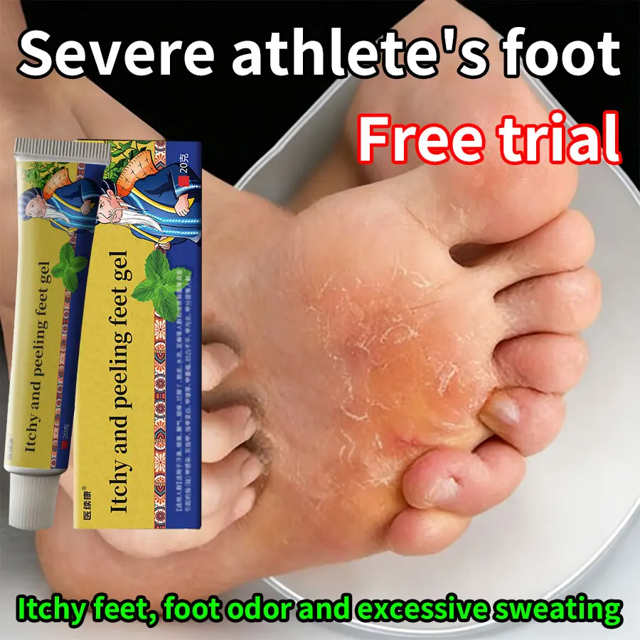 Athlete's Foot Cream: For foot odor, itchy feet, sweaty feet, cracked feet, blisters, peeling, athlete's foot, fungal infections and anti-itch relief. Foot Care Product Exfoliating Foot Peel