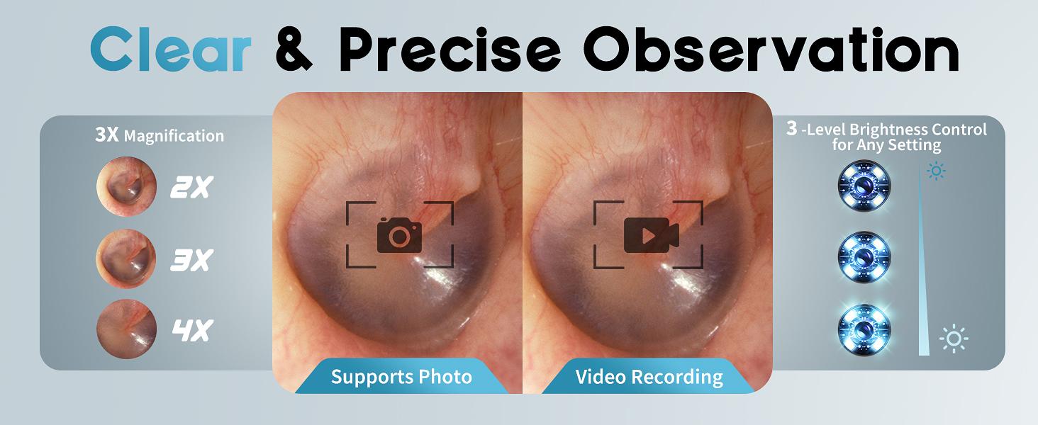 Otoscope Ear Camera with 1.21” Screen, 1080P Ear Scope with 4 LED Lights, Otoscope Camera for Adults Kids and Pets, Support Photo & Video, Type-C Charging with Computers, Baby Essentials, Home Medical