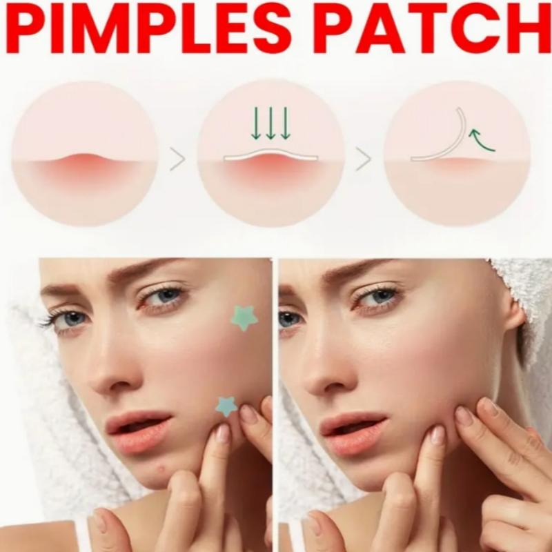Pimple Patches for Face Hydrocolloid Acne Patches Star Zit Covers Spot Stickers Mild and non-irritating Patches 3 Sizes (10mm,12mm&14mm)