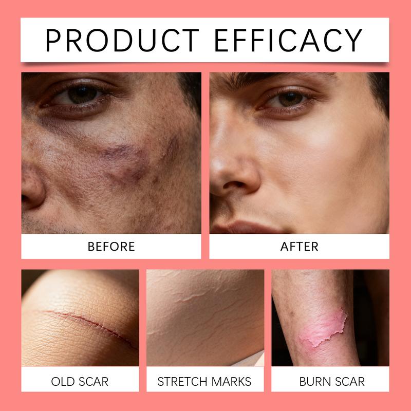 Professional Scar Removal Cream, Advanced Silicone Skin Repair Gel for Burn,Acne Old Scar Removal Cream for Face & Body | Fades Dark Scars，Moisturizing cream