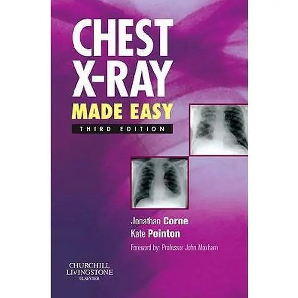 USED Book - Chest X-Ray Made Easy by Jonathan Corne MA  PhD  MB BS  FRCP (Paperback) - english