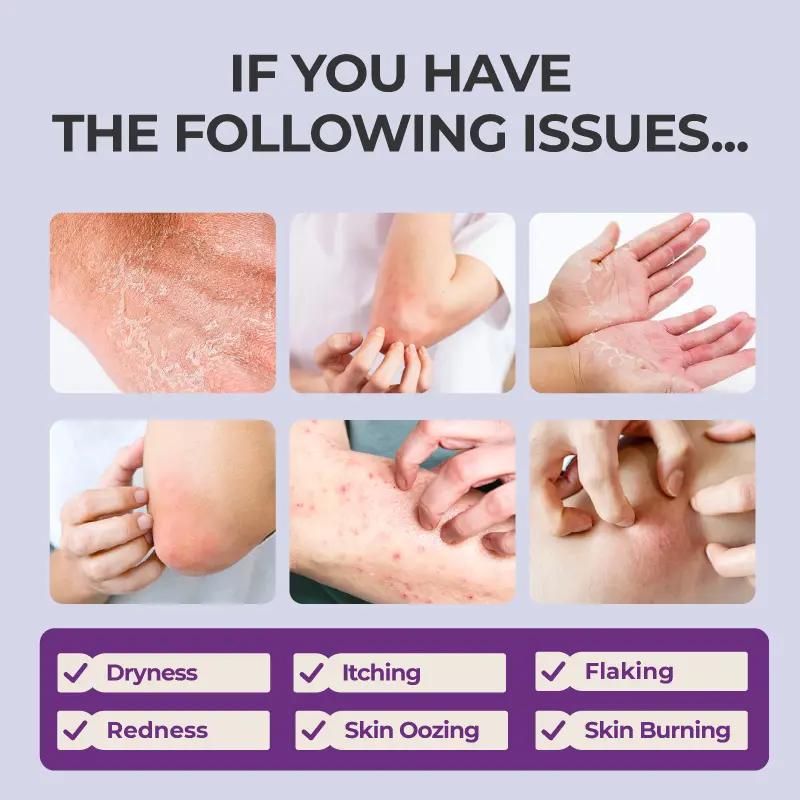 Kreain Nature Soothing Gel with Tea Tree & Cica – Gentle Calming Moisturizer for Sensitive Skin, Daily Hydration to Boost Skin Barrier