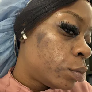 [Dr.Melaxin Official] Kojic Acid Turmeric TX Toner Pad 70pads, Dark Spot & Pigmentation Care for Uneven Skin Tone