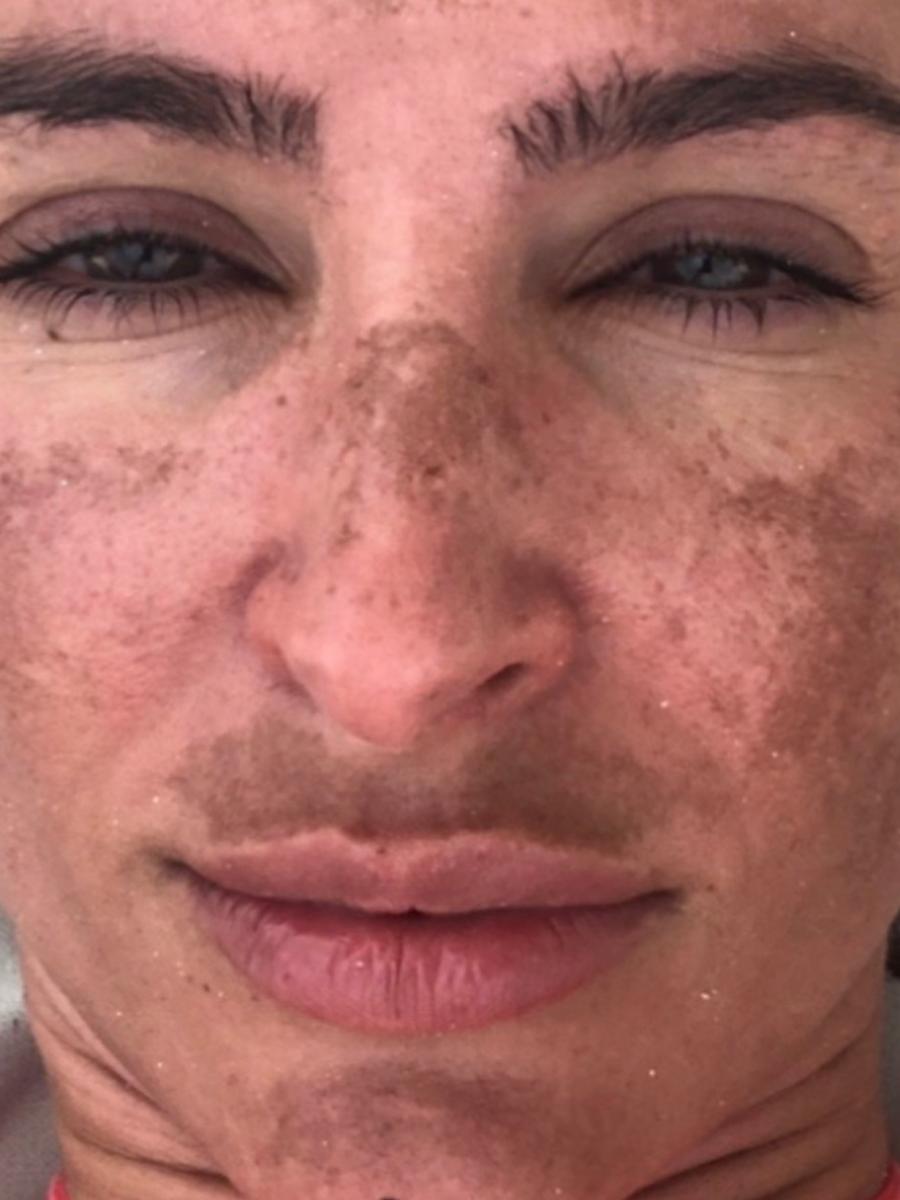 Item: 【6 Vials】50% off /15-day supply /Skin Firming