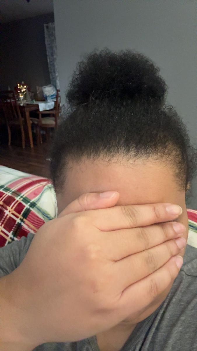 Item: Scalp Stimulator - 2oz