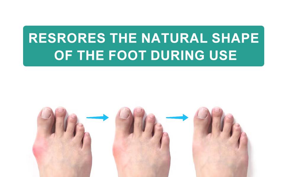 4 Pcs Toe Separator,Bunion Corrector for Women Men Toe Spacers to Correct Bunions Yoga Toes Straightener Stretcher Big Toes Correctors Gel Separators (Blue+Pink)