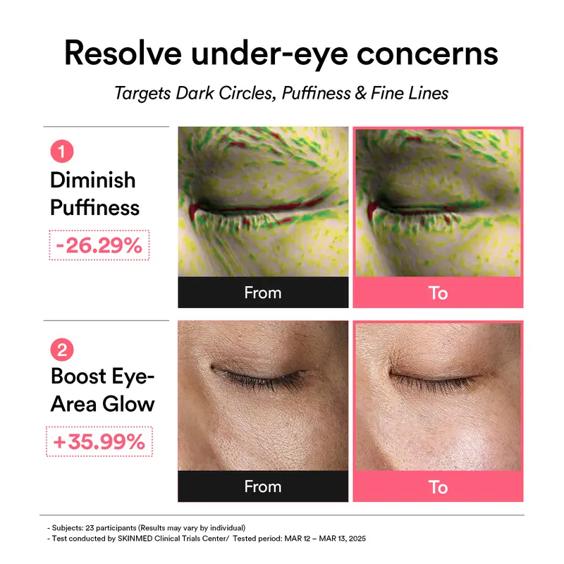 [Abib Official] PDRN Glow Jelly Eye Masks (60 Patches) - Vegan PDRN, Retinal, Caffeine Daily Care for Dark Circles, Puffiness, Fine Lines, Smile Lines, Restore Radiance, Glow Up, Night Routine