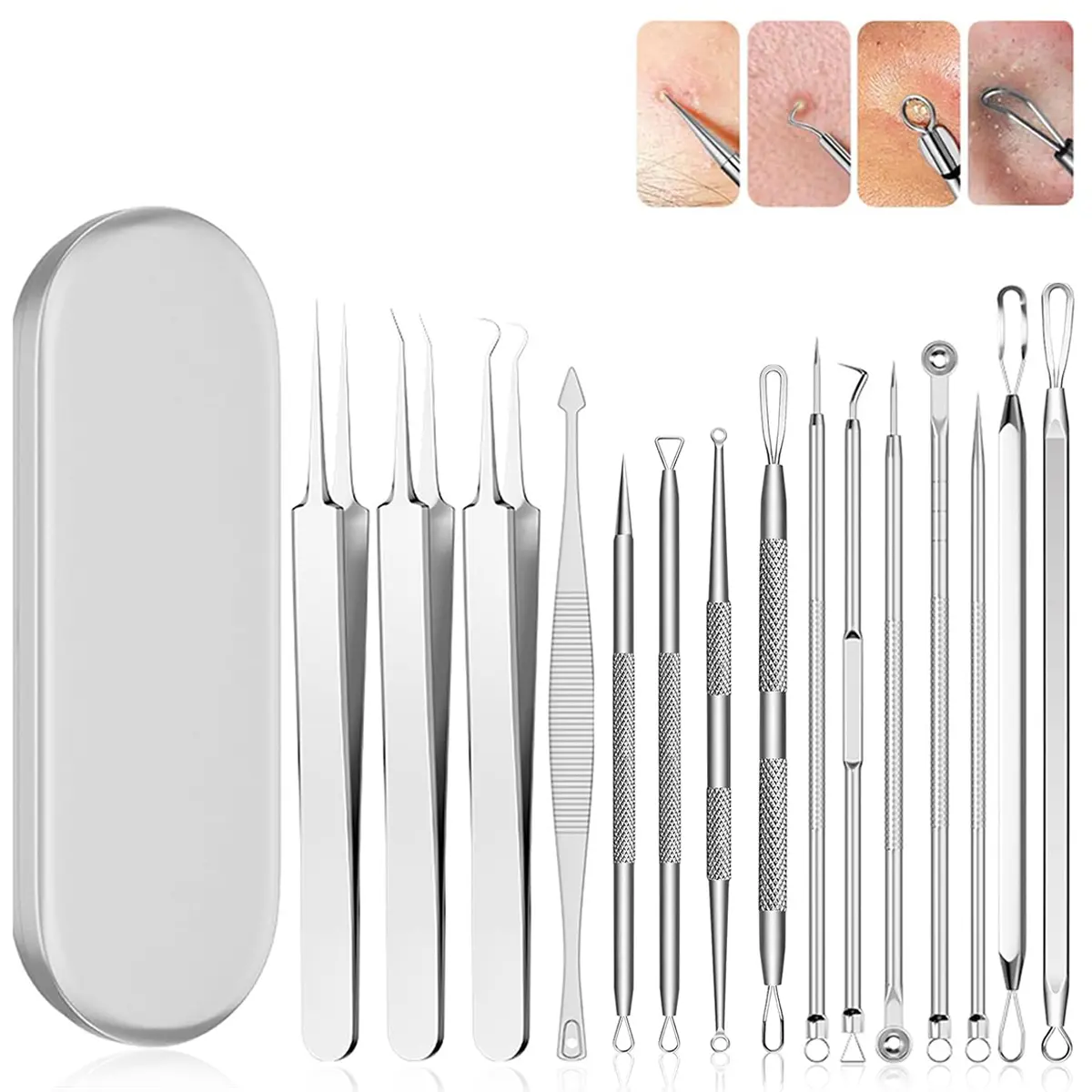 Blackhead Remover Pimple Popper Tool Kit 15 Pcs Blackhead Remover Tools Kit with Storage Case Pimple Popper Tool kit for Face Nose Deep Cleansing Pimple Extractor for Quick and Easy Removal of Pimples