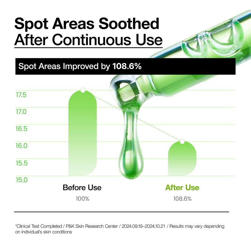 [Anua Official Shop] Azelaic Acid 10 Hyaluron Redness Soothing Serum 1.01 fl.oz.(30ml)｜Azelaicacid, Hyaluronic Acid, Non-Poreclogging, korean skincare, soothing, redness, sensitive skin, acne-prone