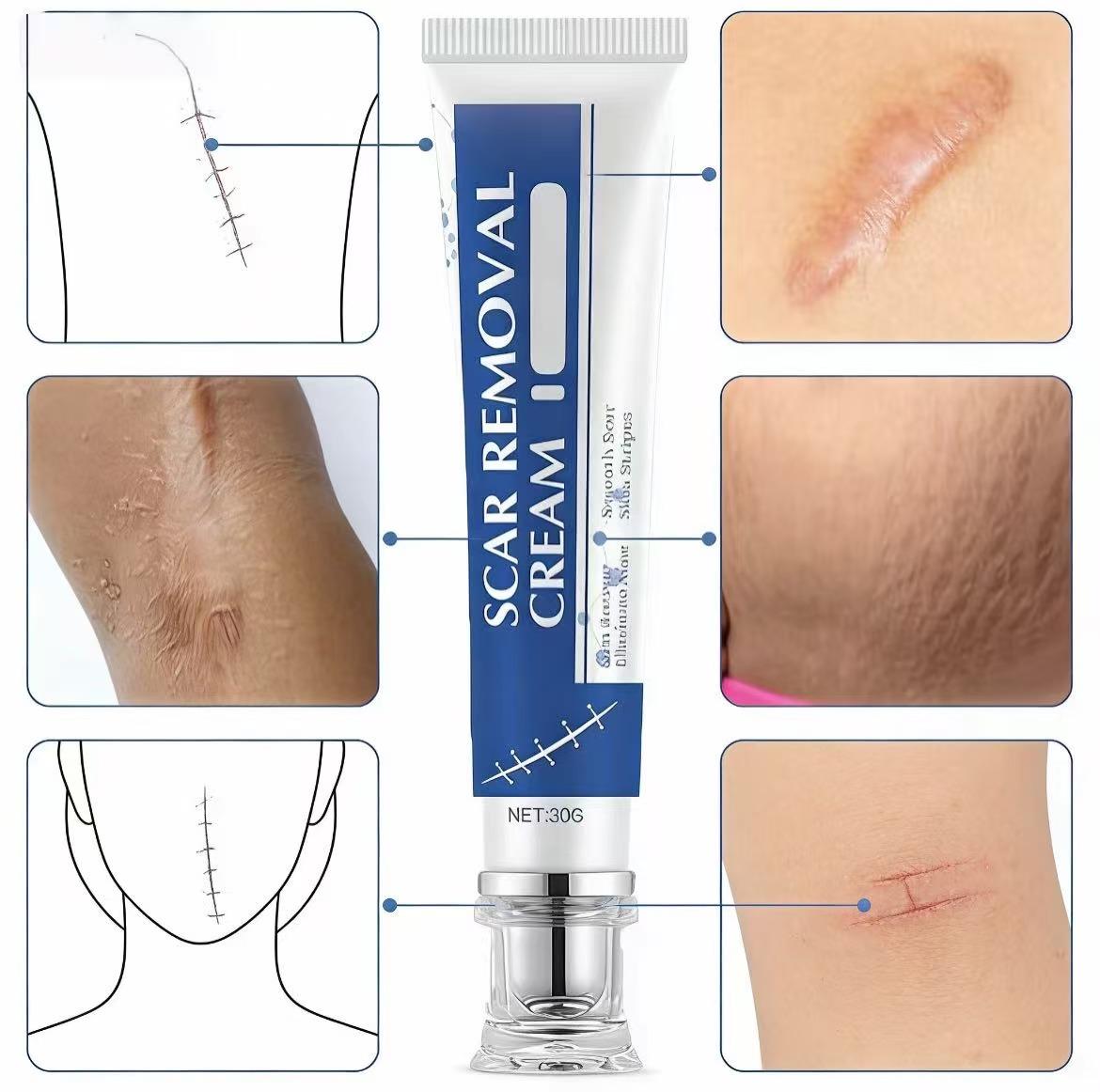 Scar Care Cream Advanced Innovative Formula Skin Repair Gel for Body Face Old & New Scars Moisturizing Smoothing Skin Care for All Skin Types Adults Kids Daily Gentle Scar Gel Summer Skin Essential