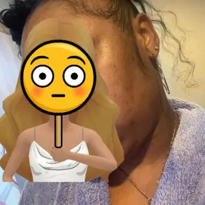 Lemon Turmeric 3pcs Kojic Acid Soap - Gentle Dark Spot Remover for Face Acne Cleanser Cream Cleansing turmeric soap Face Facial Skincare Radiant Comfort