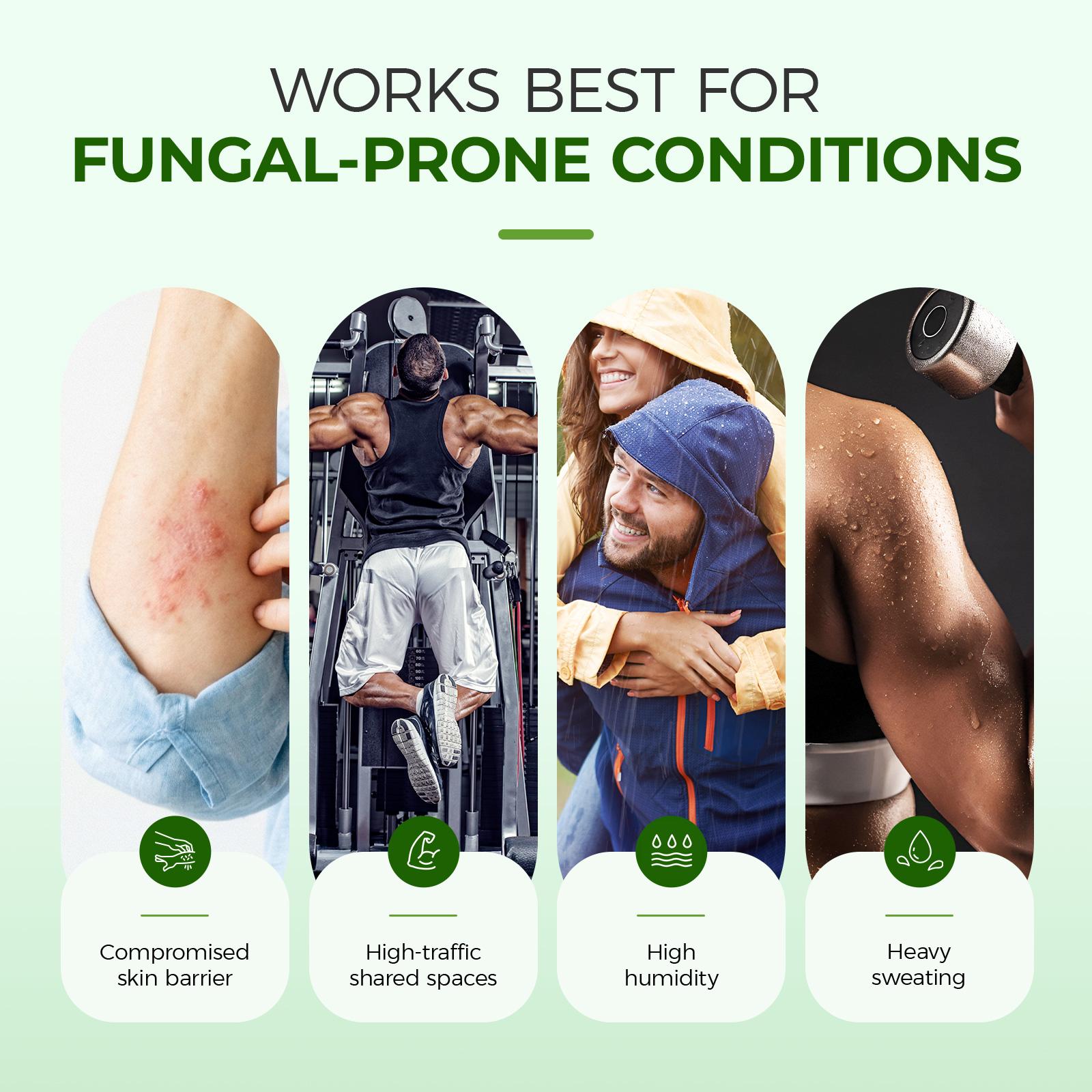 Inlifay Antifungal Cream, Advanced 2% Miconazole Nitrate for Athlete's Foot, Ringworm & Jock Itch. Effective Anti Itch Relief for Peeling, Cracked Skin & Sweaty Odor. Gentle Daily Foot & Body Care Routine for Men & Women Inlifay Antifungal Cream, Advanced 2% Miconazole Nitrate for Athlete's Foot, Ringworm & Jock Itch. Effective Anti Itch Relief for Peeling, Cracked Skin & Sweaty Odor. Gentle Daily Foot & Body Care Routine for Men & Women