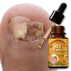 Bee Venom Nail Care Essence Liquid, Nail Care Solution, Nail Care Product, Quick Repair for Thin Nails, Nutrientrich Edge Protection, Anti-Breakage, Anti-Cracking, Beauty Nail Treatment, Nail Repair Drops