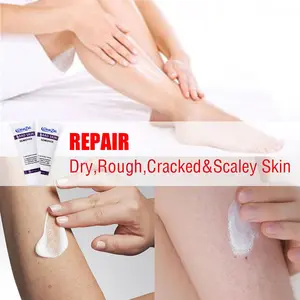 ClearZal targets chicken skin on arms and legs and enlarged pores,  improves it, and can be used all over the body Triple action formula exfoliates old skin cells 3.4 Ounce  Salicylic acid gently exfoliates dead skin cells