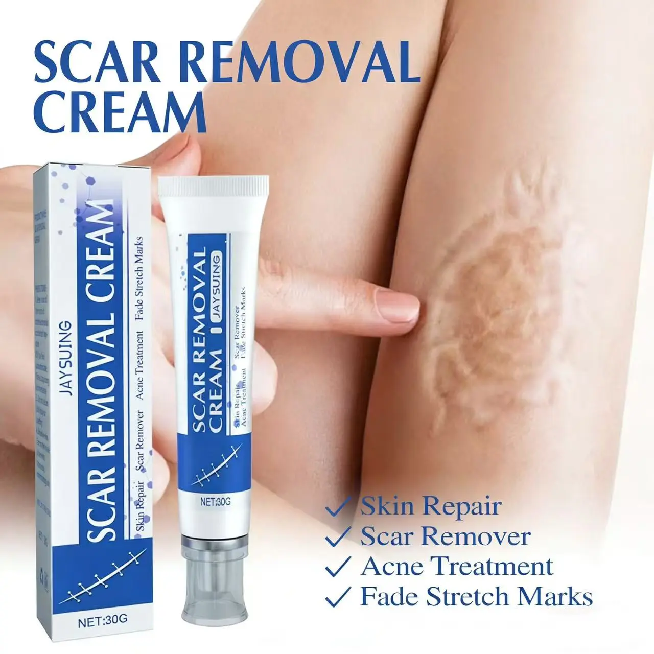 Scar Repair Cream for Old & New Surgical Scars, Stretch Marks & Acne - Gentle Treatment for Face & Body, 30g, Scar Cream For Surgical Scars
