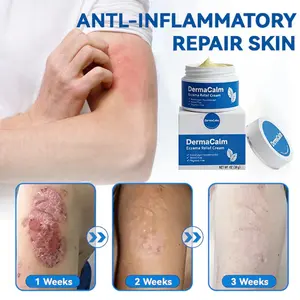 DermaCalm Eczema Relief Cream – Fast-Acting, Plant-Based, Fragrance-Free, Non-Irritating Healing Cream for Sensitive Skin – Safe for Sensitive Skin, Relieves Eczema, Blisters, Dry & Itchy Skin – 30g